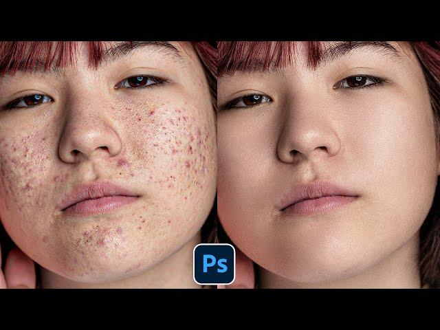 Face Retouching - Best Photoshop Tutorial | Skin Retouching 2024