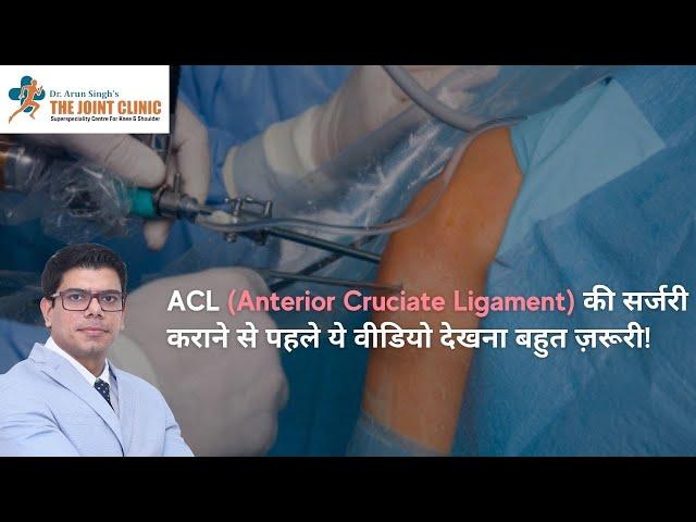 ACL (Anterior Cruciate Ligament) की सर्जरी कराने से पहले ये वीडियो देखना बहुत ज़रूरी!