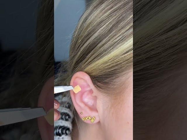 Do ear seeds work? | #Shorts
