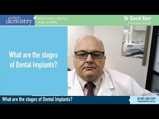 What are the stages when getting Dental Implants?