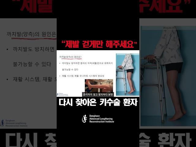 잘못된 키수술 후 ,부작용으로 굴곡변형,회전변형,까치발 등 여러가지 합병증을 안고 온 환자