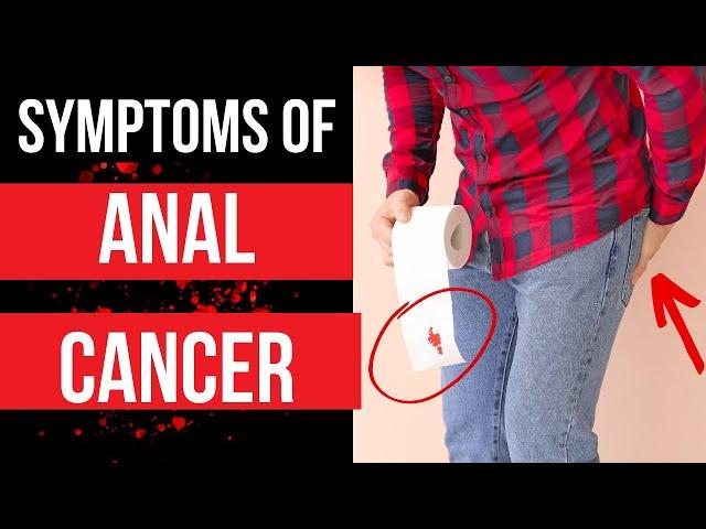 Doctor explains SYMPTOMS OF ANAL CANCER - plus risk factors, diagnosis and treatment