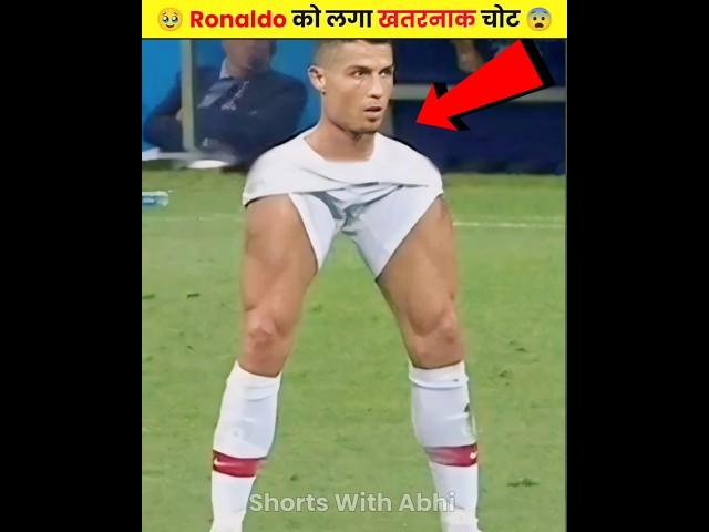 Ronaldo को लगा खतरनाक चोट  || Cristiano Ronaldo injured  || cr7 #shorts #ytshorts #ronaldo