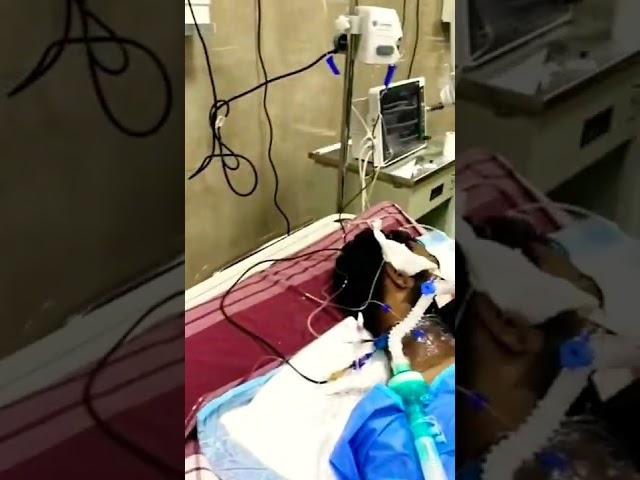 Off Of Mechanical Ventilator   #medical #nursing #hospital