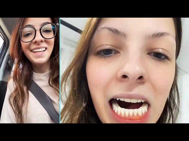 I Lost My Teeth In My 20s - The Positivity Fix