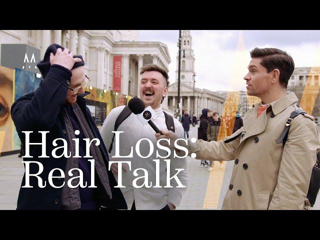 Street Talk: Men Open Up About Hair Loss!