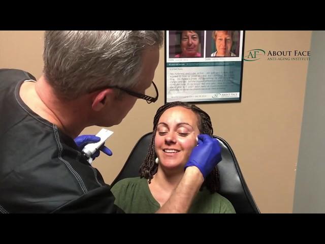 Quick Botox Treatment Video