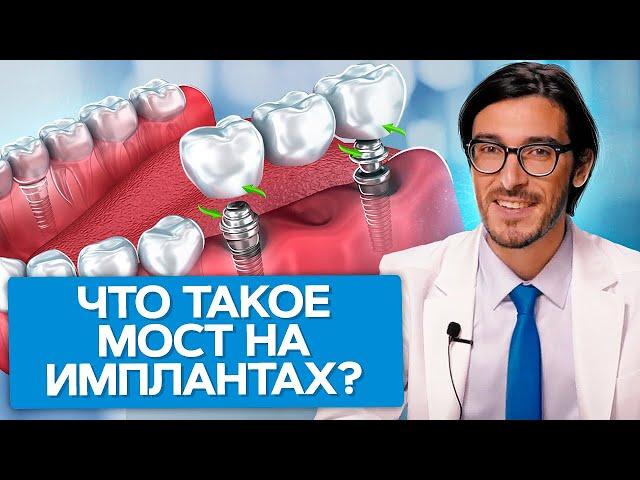 Что такое мост на имплантах? Что такое мост на имплантах и как сэкономить на имплантации зубов?