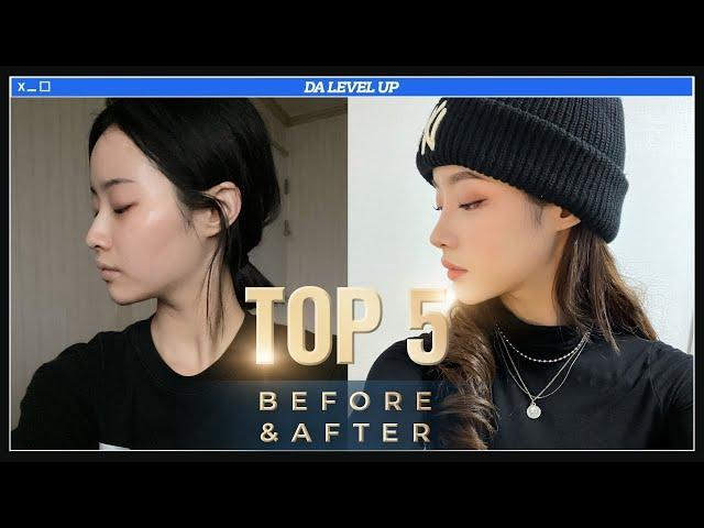 [Plastic Surgery in Korea] TOP 5 Plastic Surgery Before and After at DA!