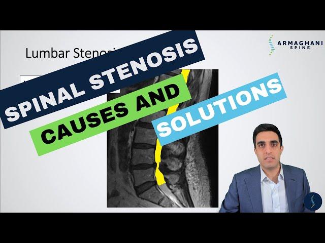 Lumbar Spinal Stenosis - What is the cause and how will I get better?