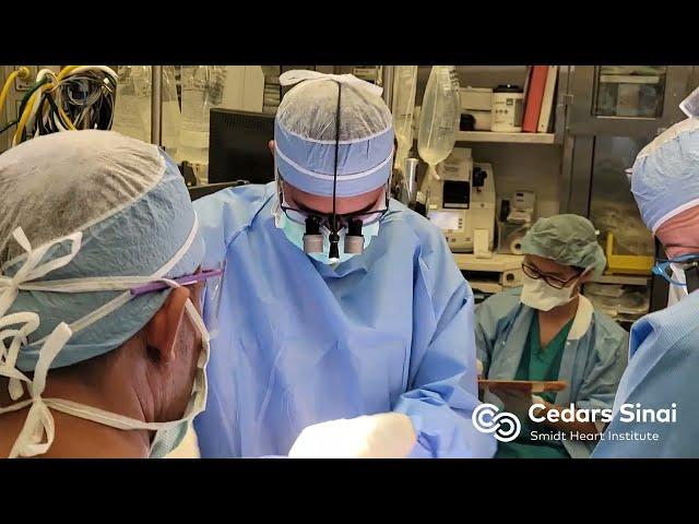 Case Numbers | Cedars-Sinai Thoracic Surgery—Integrated Residency