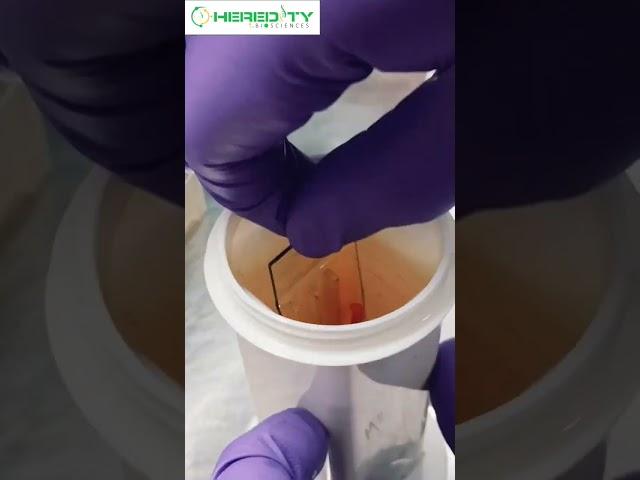 Ziehl–Neelsen staining #hereditybioacademy #reels