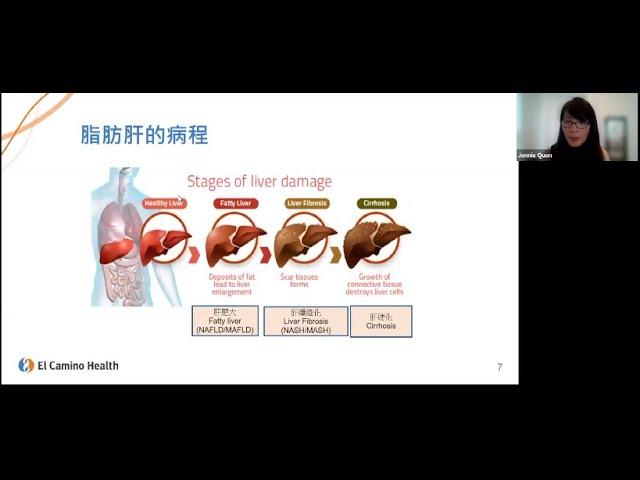 「如何改善和預防脂肪肝」註冊營養師關潘靜儀主講 How to Improve and Prevent Fatty Liver | El Camino Health