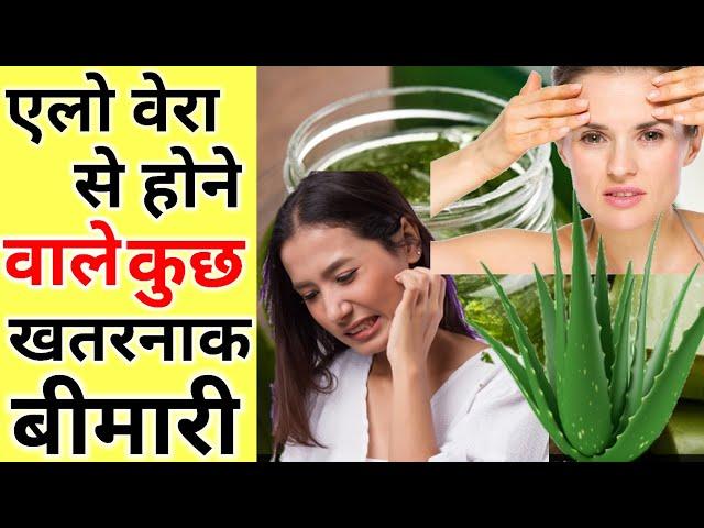 एलो वेरा से होने वाले कुछ खतरनाक बीमारी |  aloe vera benefit and side effect  | #shorts