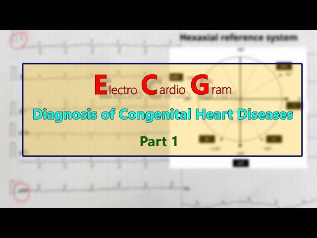 ECG: Diagnosis of Congenital heart diseases PART 1