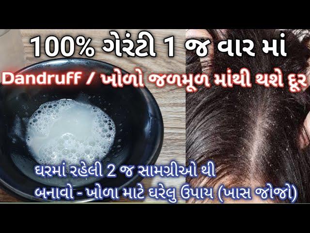 100% ગેરંટી ખોળો ૧ જ વાર માં  જળમુળ માંથી દૂર કરો કોઈ ખર્ચ વગર (ખાસ જોજો) dandruff treatment at home