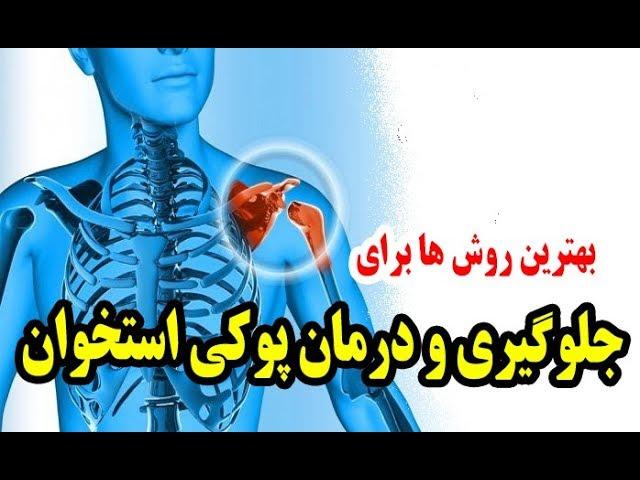 جلوگیری و درمان پوکی استخوان