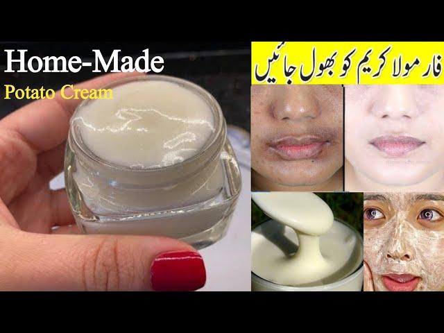 potato cream for face | remove dark spots | pigmentation