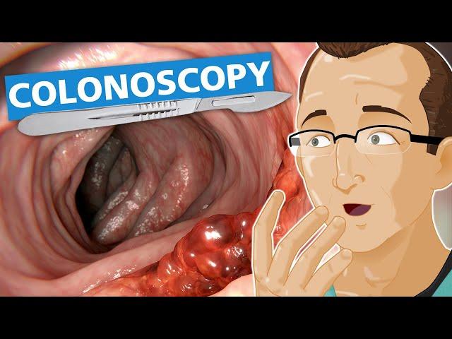 Colonoscopy