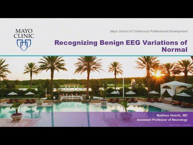 Recognizing Benign EEG Variations of Normal by Matthew T. Hoerth, MD | Preview