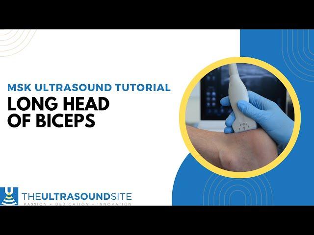 How to scan the long head of biceps on MSK Ultrasound