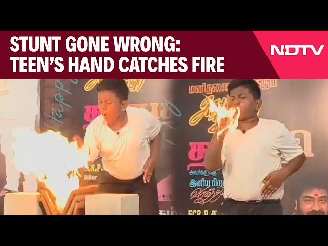 Fire Accident | Teen Catches Fire While Performing At An Event To Commemorate Actor Vijay's Birthday