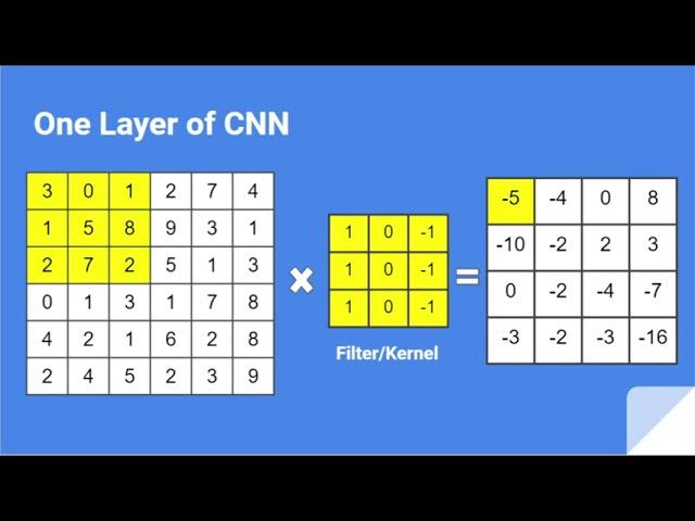 Understanding of Convolutional Neural Network (CNN) — Deep Learning