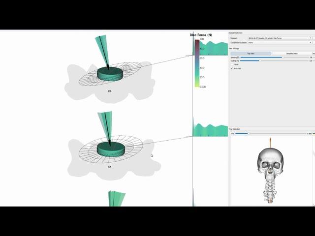 Visualization of Human Spine Biomechanics for Spinal Surgery