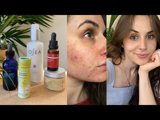 My Skin Care Routine & How I Cleared my Acne Without Fancy Products | minimalist & low waste