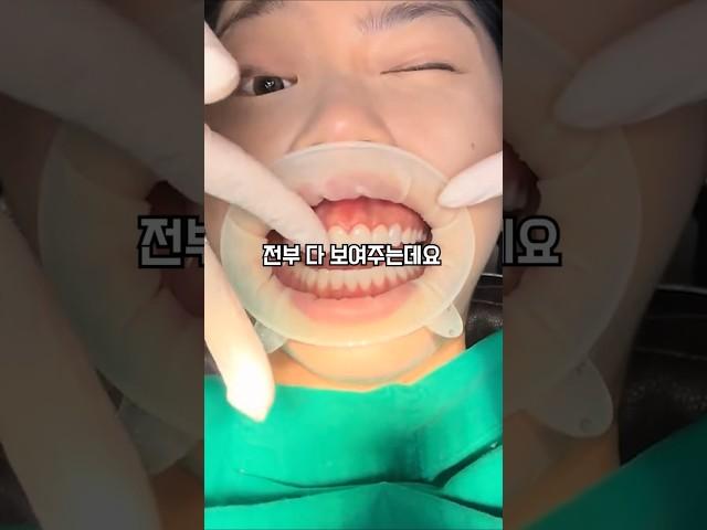 잇몸 성형하고 자신감 회복한 에이미