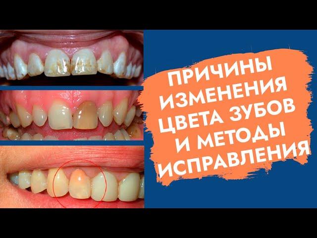 Зуб изменил цвет. Зуб потемнел. Причины. Как помочь?