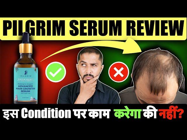 Pilgrim Advanced Hair Growth Serum Review - Genuine Tips