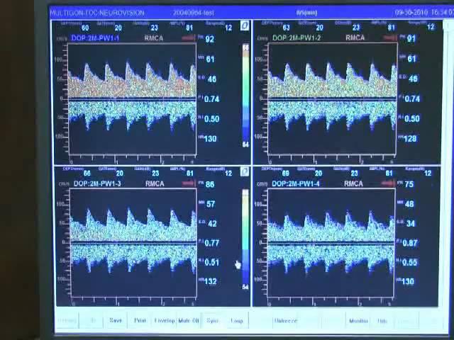 Multigon TOC 2M Transcranial Doppler