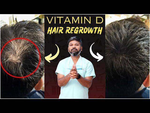 #AskDrJohnWatts | VITAMIN - D  HAIR REGROWTH | Hair Specialist Explains