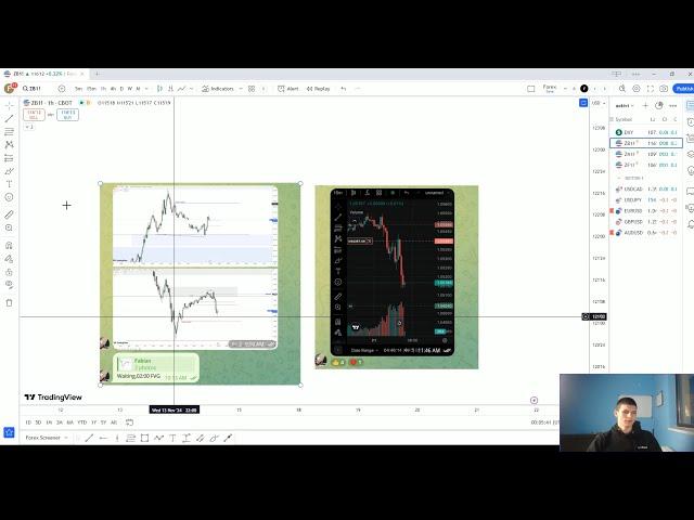 Forex Romania - Am pierdut 380 LEI intr-o zi la 19 ani  - Trade Review