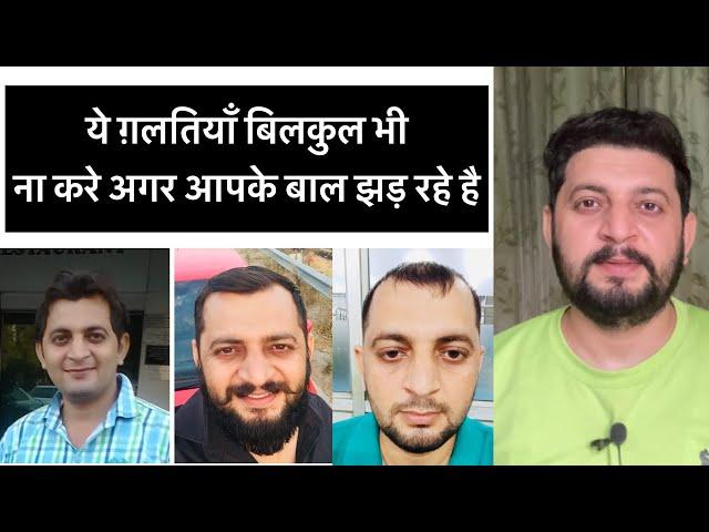 My hair loss journey | my condition before hair transplant |