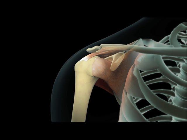 Rotator Cuff Shoulder Surgery