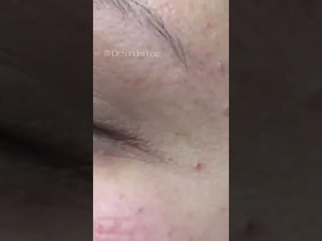 For you soft poppers out there - the one at the end is probably worth the wait... ️️⁠⁠