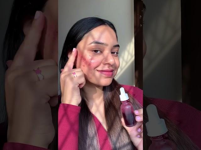 Diy home made pink tint || so pigmented  | #cheektint #blush #rajnandini #thesassynandini