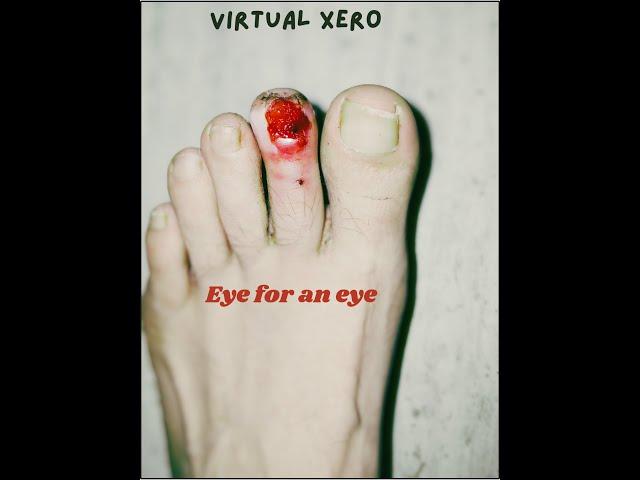 Emo Folk Punk With Xero