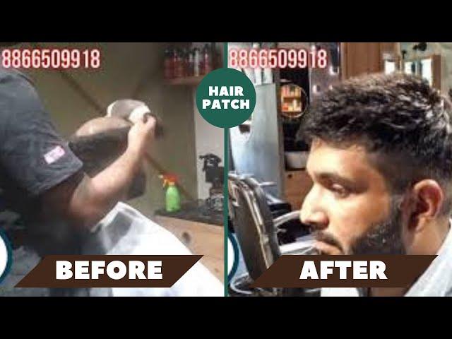 Hair Patches For Men | Hair Transformation | Ashwin Hair Studio | Rajkot