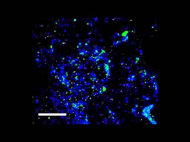 Transfusion of Human Platelets Treated with Mirasol Pathogen Reduction Technology Does Not Induce...