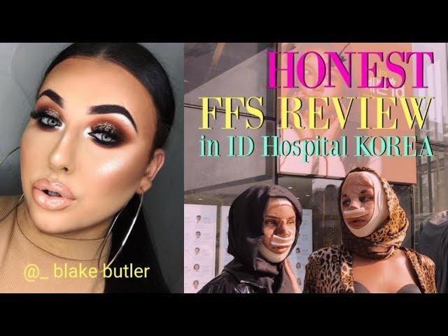 BLAKE BUTLER_ HONEST REVIEW OF PLASTIC SURGERY IN ID HOSPTIAL KOREA