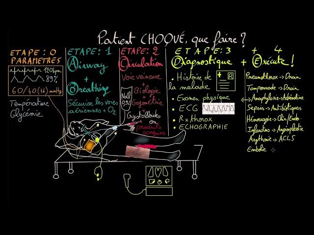 Shock - ABCDE - Treatment & diagnosis - Docteur Synapse