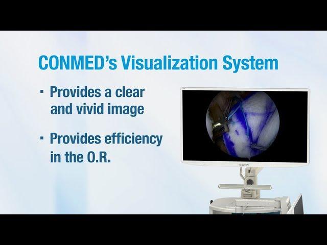 CONMED IM8000 Visualization System - CONMED Product Video