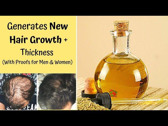 100% Proved | PERFECT ESSENTIAL OIL Blend For HAIR THICKNESS, BALDNESS HAIR REGROWTH & Dandruff