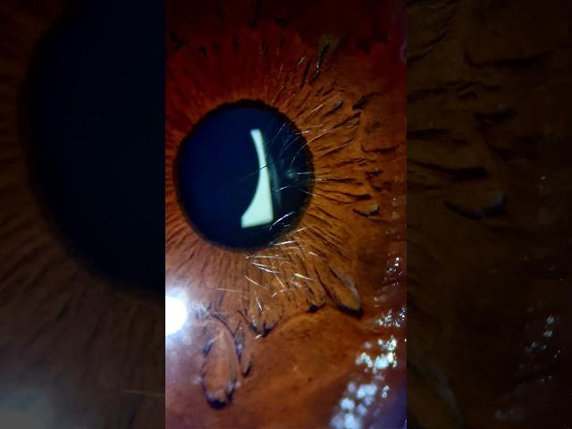 I Put My Eye under Microscope