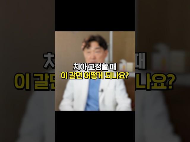 치아 교정할 때 이 갈면 어떻게 되나요? #치아교정 #교정 #이갈이 #교정과정 #교정후기