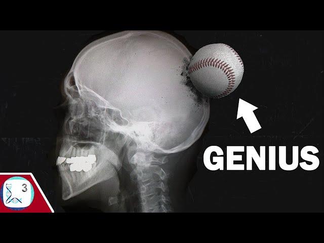 How a Baseball Injury Made A Genius (Savant Syndrome)