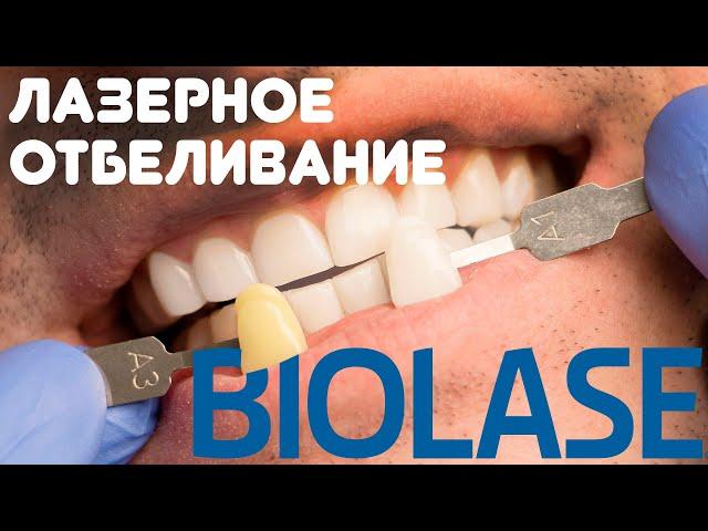 Лазерное отбеливание зубов Biolase